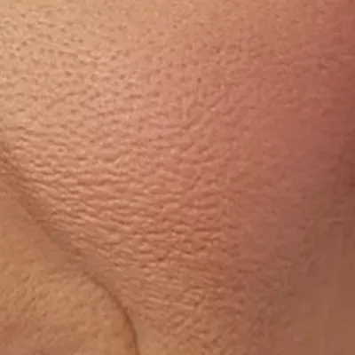 Katy Perry's skin tone — cool fair clear, Bright Winter quality