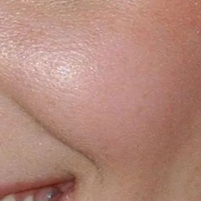 Mischa Barton's skin tone — warm fair soft, Soft Autumn quality